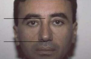 Reduction Structured Rhinoplasty
