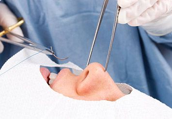 Rhinoplasty in Beverly Hills, CA