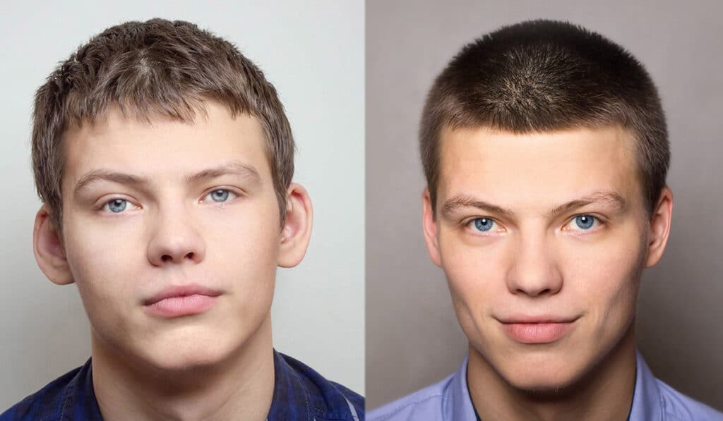 Surgery on adults and children will get rid of ear deformities.