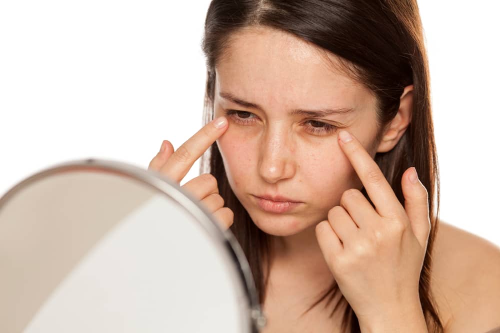 Woman pointing at wrinkles around her eyes in relation to Botox