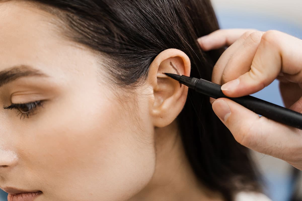 Doctor drawing a line on a female patient's ear in relation to an alternative procedure to the otoplasty surgery.