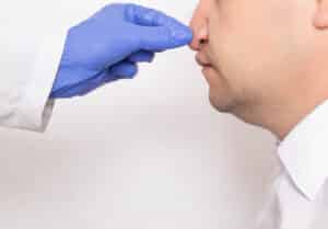 Treating a Drooping Nasal Tip