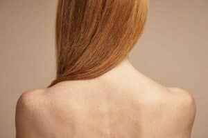 Back view of a woman’s neck with smooth trapezius muscles, highlighting cosmetic benefits of Botox for neck contouring.