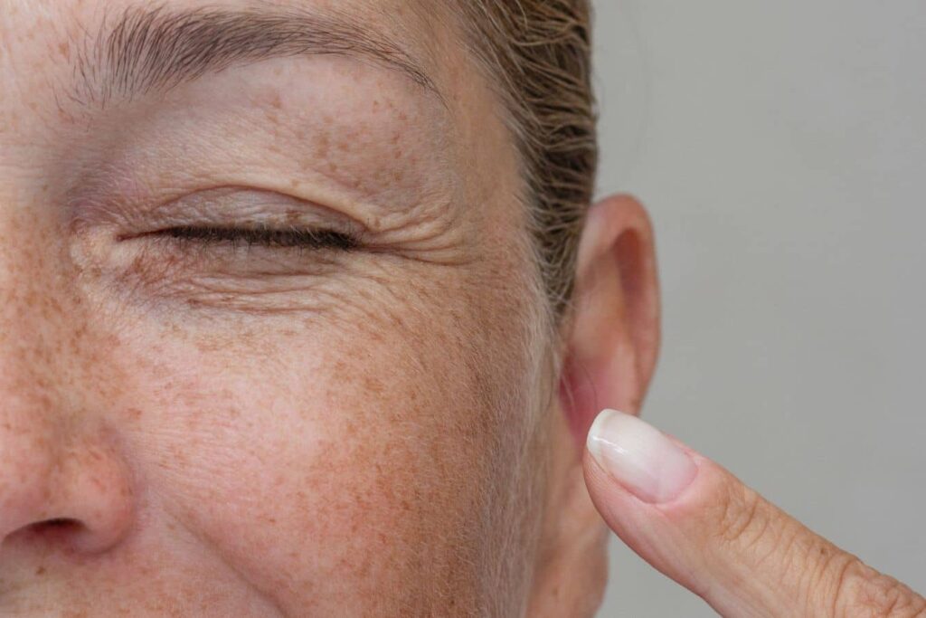 Close-up of mature eye with fine lines, representing Botox treatment for smoother skin and refreshed eye appearance