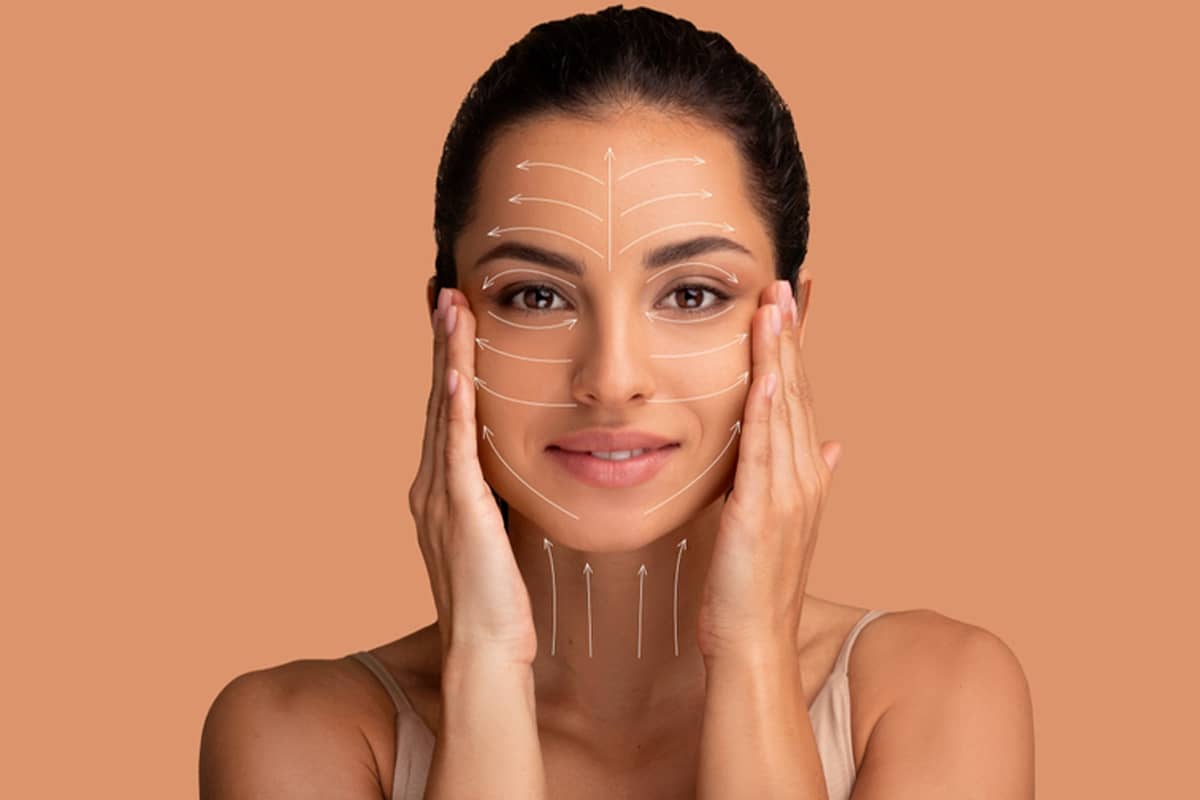A woman’s face with white surgical mapping lines and arrows drawn across her forehead, cheeks, and neck to indicate lift and contouring points.